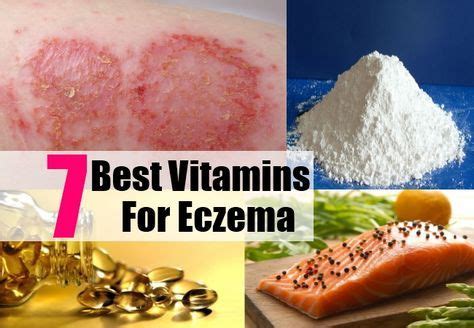 best vitamin for eczema|supplements for skin healing.